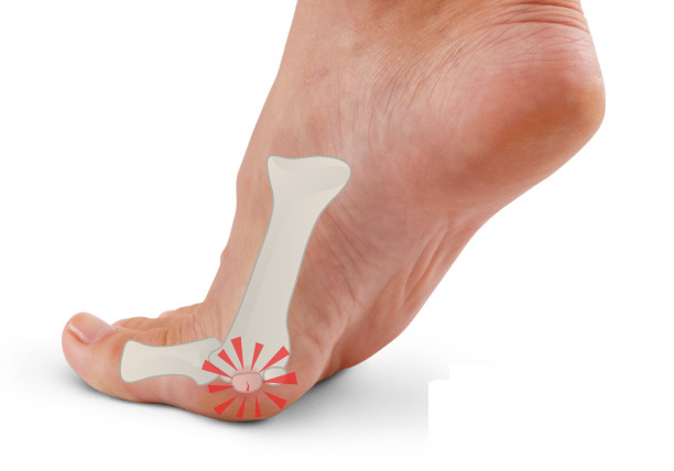 ball of foot and toe pain causes