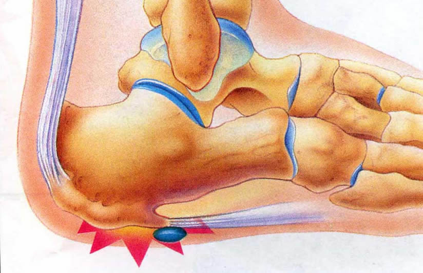 Plantar Fascia